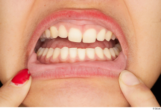 Amal teeth 0003.jpg
